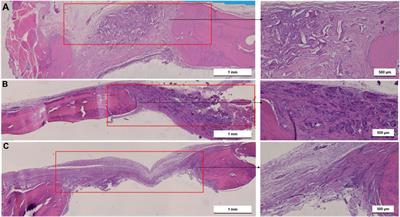 Bone regeneration driven by a nano-hydroxyapatite/chitosan composite bioaerogel for periodontal regeneration